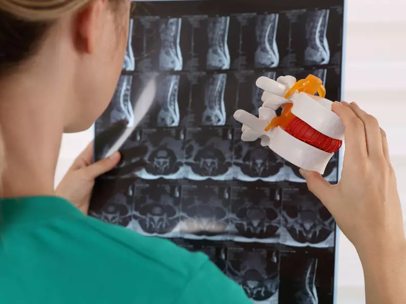 Best Chiropractor For X-rays Near Me in Fort Worth, Texas. Chiropractic X-Ray Services.