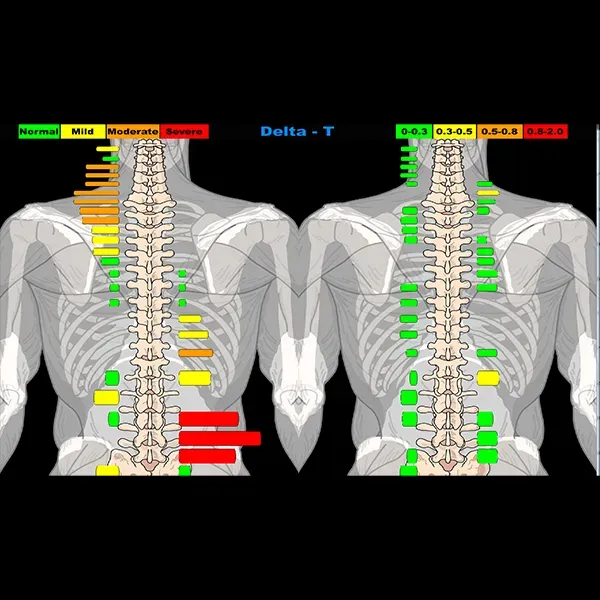 Best Chiropractor For Thermography Near Me in Fort Worth, Texas. Gateway Chiropractic.